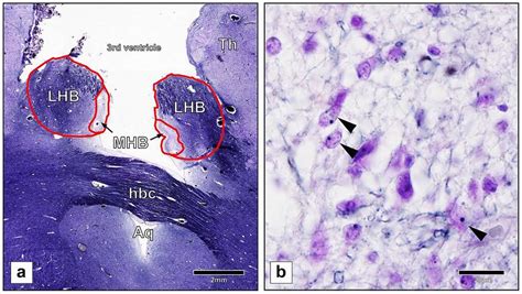 A Delineation Of The Medial Mhb And Lateral Lhb Habenula Of The Download Scientific Diagram