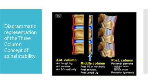 Spinal Trauma Spinal Cord Injury