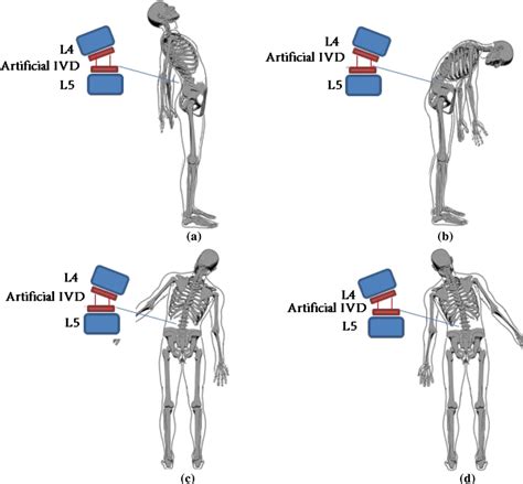 Extension Movement