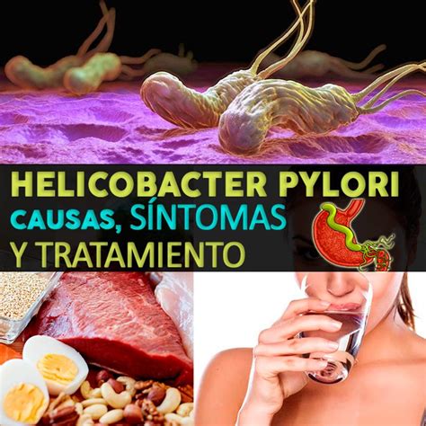 Helicobacter pylori causas síntomas tratamiento La Guía de las