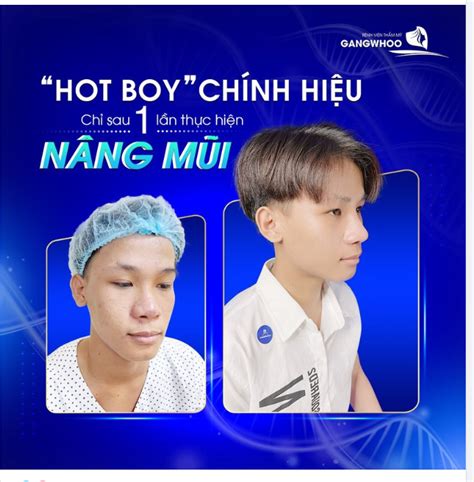 HÓA HOT BOY CHỈ SAU LẦN THỰC HIỆN NÂNG MŨI