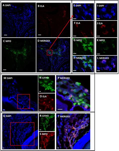 Representative Immunofluorenscent Histological Sections Of Nets In