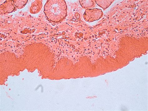 Epitelio Estratificado Escamoso O Plano