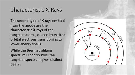 A Level Physics Medical Physics 1 Production Of X Rays Youtube