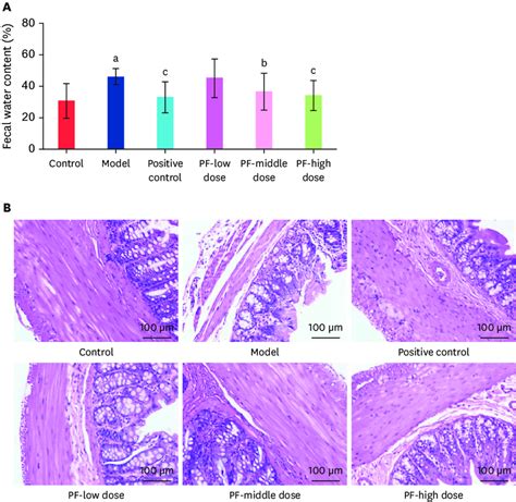 Fecal water contents. (A) Fecal water contents after modeling and... | Download Scientific Diagram