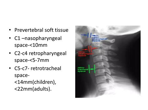 X ray c-spine | PPT