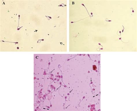 Hypo Osmotic Swelling Hos Response In Sperm After Treating With