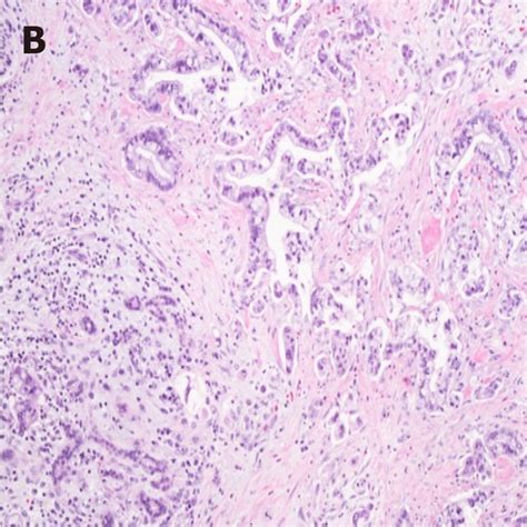 Hematoxylin And Eosin Stains[21] A Hematoxylin And Eosin Stains Of