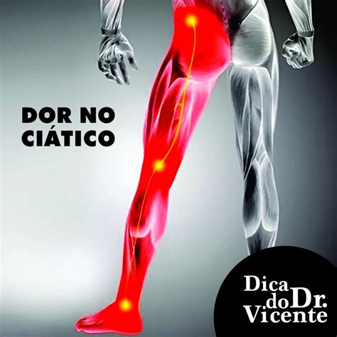 Dor No Ciático Revista Nossa