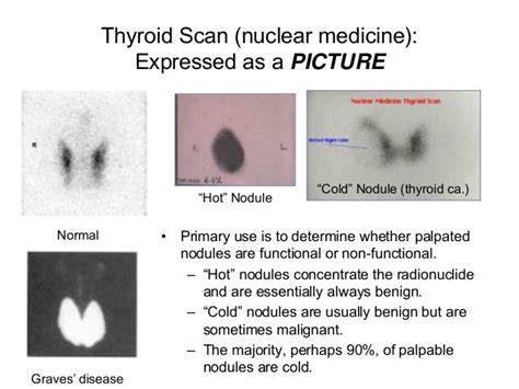 Thyroid