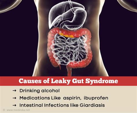 Causes Of Leaky Gut Syndrome