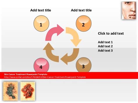 Skin Cancer Treatment Powerpoint Template