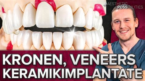 Keramikzahnimplantate Veneers Und Kronen Versorgt Ober Und