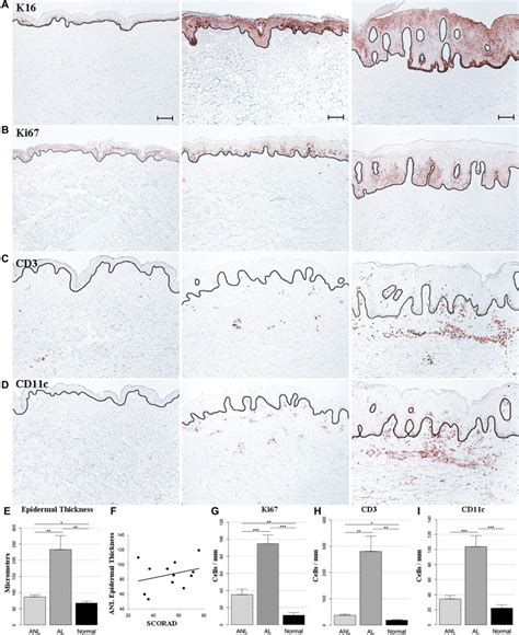 Nonlesional Atopic Dermatitis Skin Is Characterized By Broad Terminal