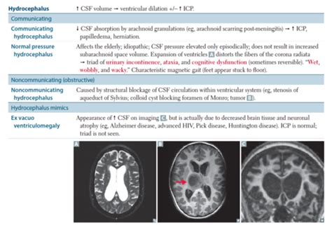 Hydrocephalus Herniation Trauma Bleeds Strokes Flashcards Quizlet