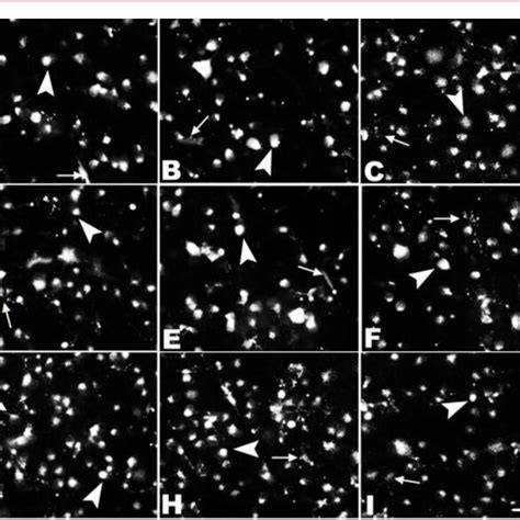 Microphotographs Of Fluorogold Labeled Surviving Retinal Ganglion Cells