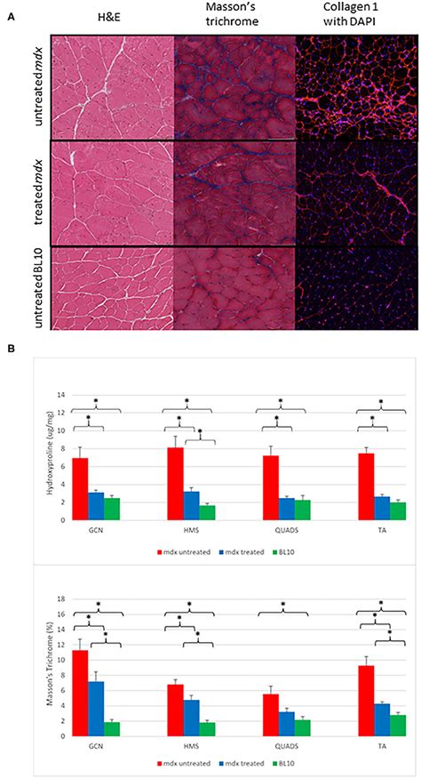 Frontiers Use Of Ep Enhanced Magnetic Resonance Imaging As A