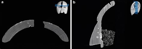 Figure 1 From Cultural Heritage Image Analysis And Support Modeling