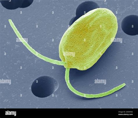 Dunaliella salina. Coloured scanning electron micrograph (SEM) of ...