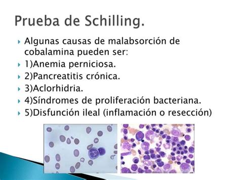 S Ndrome De Malabsorci N Intestinal Ppt