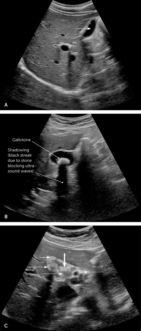 Point Of Care Ultrasonography Aafp