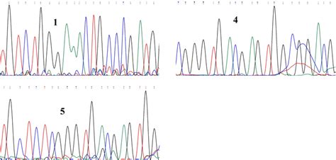 The Nucleotide Sequences In Form Of Chromatograms For Isolates Numbers Download Scientific