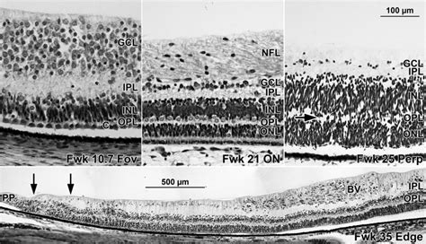 Development Of Retinal Layers In Prenatal Human Retina American