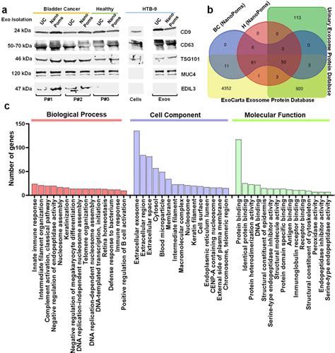 The Proteomic Analysis Of Bladder Cancer Patient Urinary Exosomes A