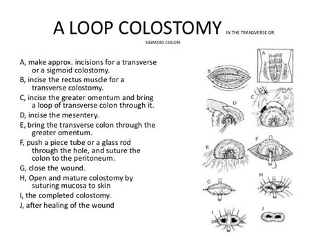 Colostomy