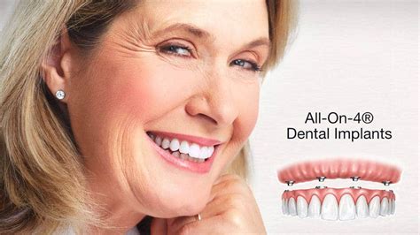 2019 Guide To All On 4 Dental Implants In Houston Texas Omega Dental