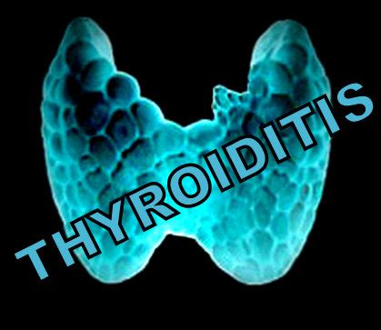 Thyroiditis-the inflammation of your thyroid gland - Stop The Thyroid ...