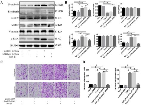 Knockdown of Smad2 3 blocked TGF β1 induced EMT and inhibited migration