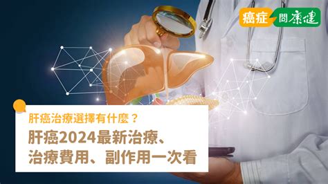 肝癌治療選擇有什麼？肝癌2024最新治療、治療費用、副作用 癌症問康健