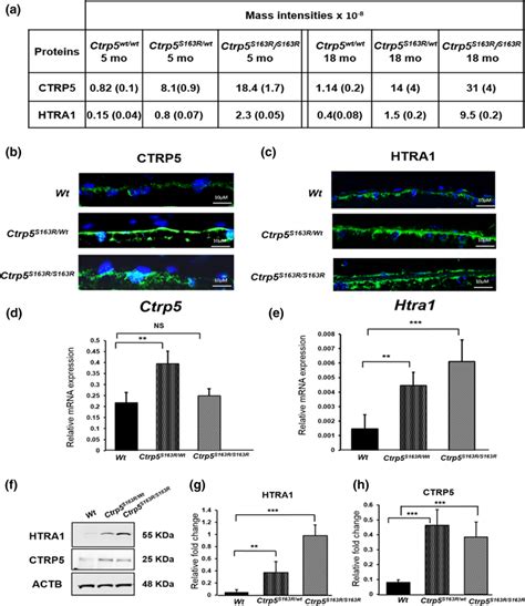 Accumulation Of CTRP5 And HTRA1 In Mice Expressing Mutant CTRP5 A