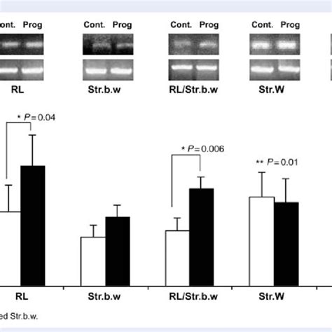 Plexin B Pb Mrna Levels In Endometrial Cell Cultures A