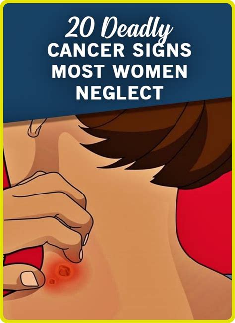 Lung cancer symptoms – Artofit