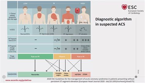 2020 Esc Guidelines On Nsteacs 10 Key Concepts To Remember And