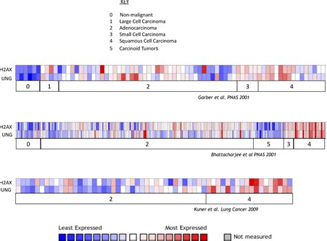 Uracil DNA Glycosylase UNG Loss Enhances DNA Double Strand Break