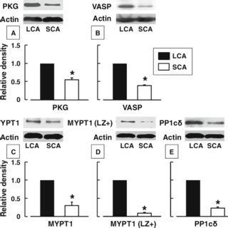 Protein Levels Of Pkg A Vasp B Mypt C Mypt Lz D And