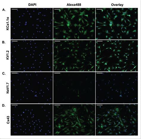 Full Article Membrane Channel Gene Expression In Human Costal And