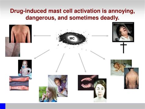 Ppt Drug Induced Urticaria Powerpoint Presentation Free Download Id 4932291