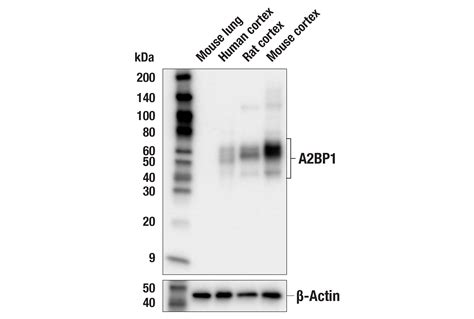 A2BP1 E8R9Z Rabbit MAb Cell Signaling Technology