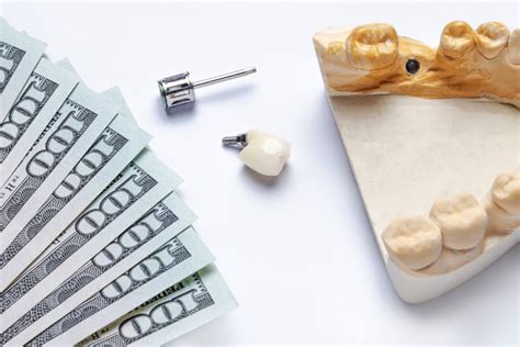 How Much Do Dental Implants Cost A Complete Guide For 2024