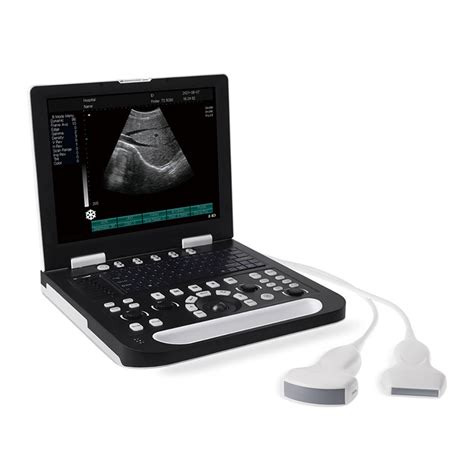 Icen Ultrasound Scanner Portable Ultrasound Ultrasound Therapy Machine