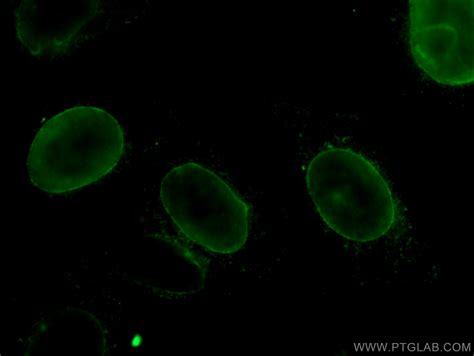 Lamin A C Antibody Ap Proteintech