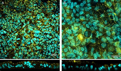 Immunostaining Of Tight Junction Protein Zo Cell Nuclei Are Shown In