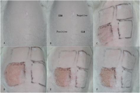 Dermal irritation test. (A) The shaved back and trunk areas. (B) Test ...