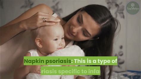 Baby Psoriasis Appearance Diagnosis And Management Youtube