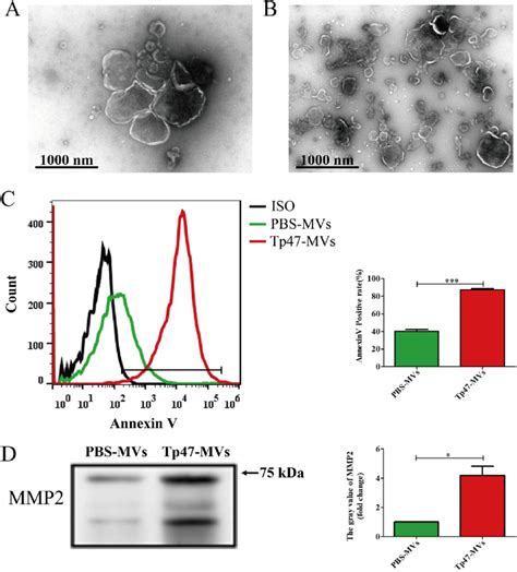 Identification Of THP 1 Cell Derived Microvesicles A And B