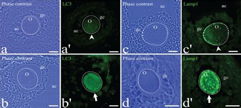 Immunodetection Of The Pro Autophagic Proteins LC3 And Lamp1 In Atretic